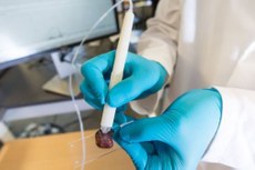 Dispositivo portátil permitirá que uma cirurgia para retirada de tumor seja feita de forma mais rápida, segura e precisa