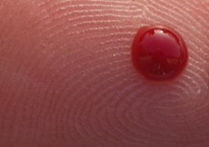O diagnóstico precoce, feito através do teste de glicemia, contribui para a prevenção da diabetes