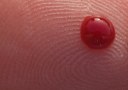 O diagnóstico precoce, feito através do teste de glicemia, contribui para a prevenção da diabetes